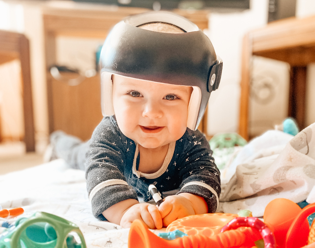 [Alt-text]: a baby wearing a cranial helmet positioned in prone on forearms on the floor with neck extended smiling gazing into camera